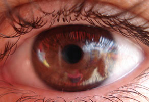 Choose: Give Up the Internet Forever or an Eye – 40% Lost the Eye